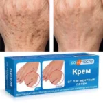 Kem chống đồi mồi Kpem Nga – Mờ thâm nám, làm sáng và đều màu da - Ảnh 2