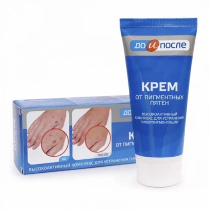 co_nen_su_dung_kem_tri_doi_moi_o_tay_kpem_4_428c9a9aef